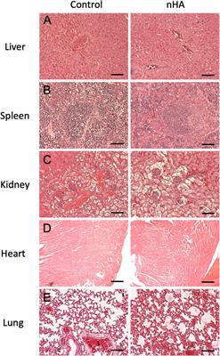 Longitudinal in vivo biodistribution of nano and micro sized hydroxyapatite particles implanted in a bone defect